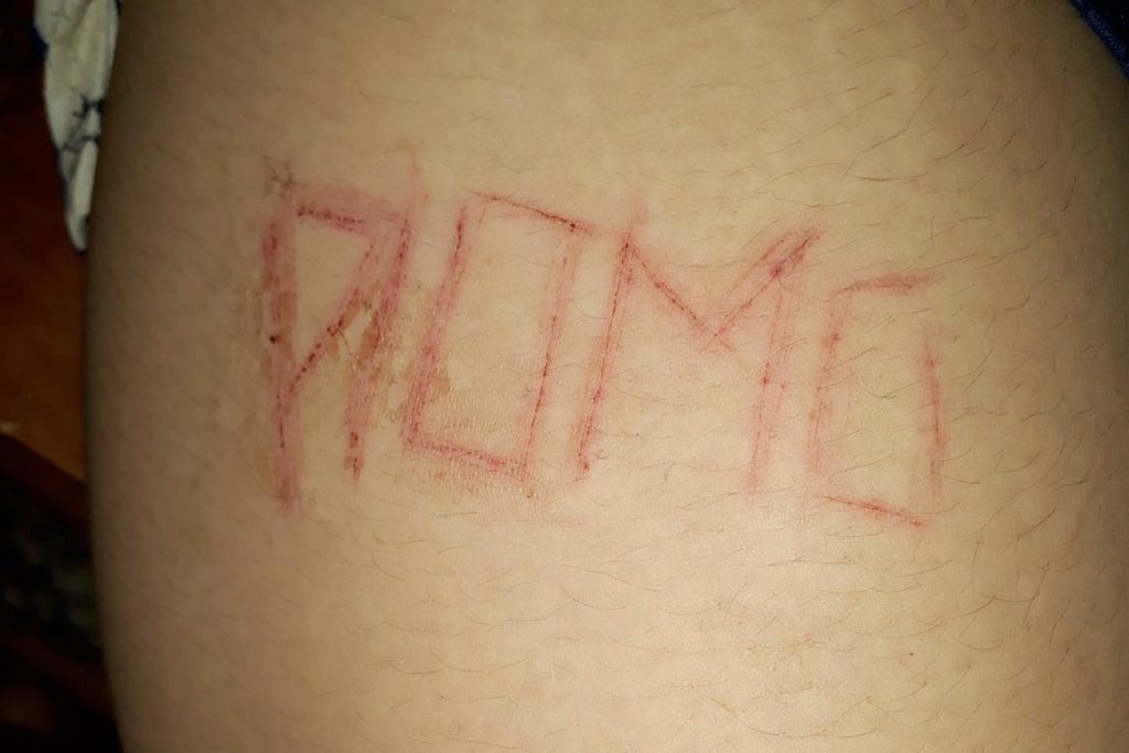 Palabra plomo tatuada en la pierna de una joven despues de ser agredida sexualmente por paramilitares en Nicaragua